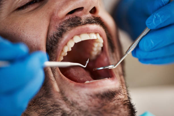Best Full Mouth Reconstruction  in Port Townsend, WA